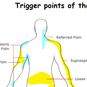 Trigger Points of the Body Worksheet Download