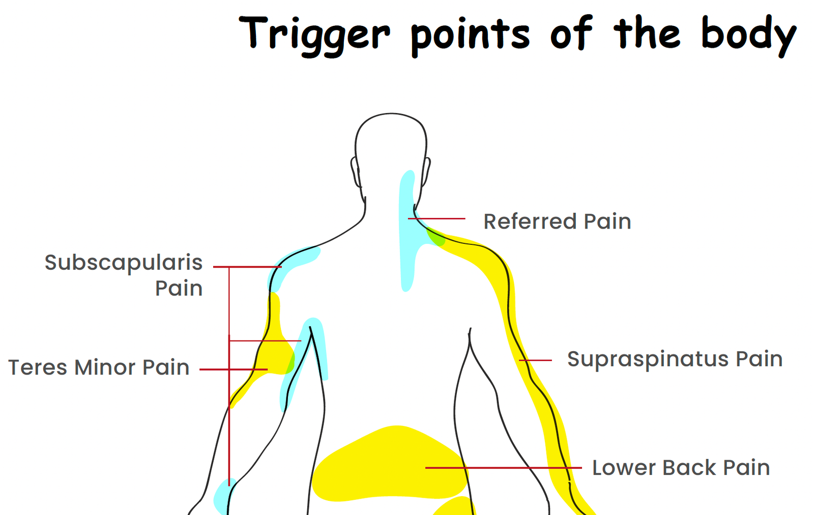 trigger points of the body worksheet